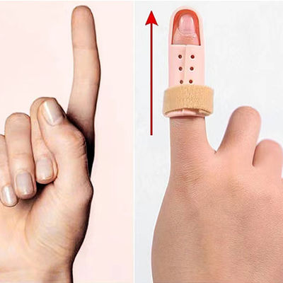 High Performance Medical Plastic Injection Mold for Finger fixator